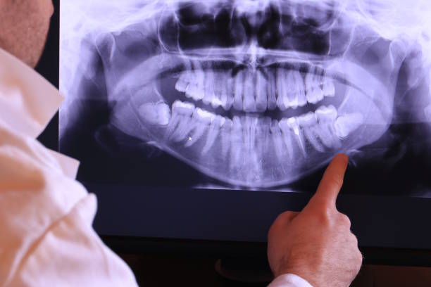 Best Emergency Treatment for Toothache in Montebello, NY